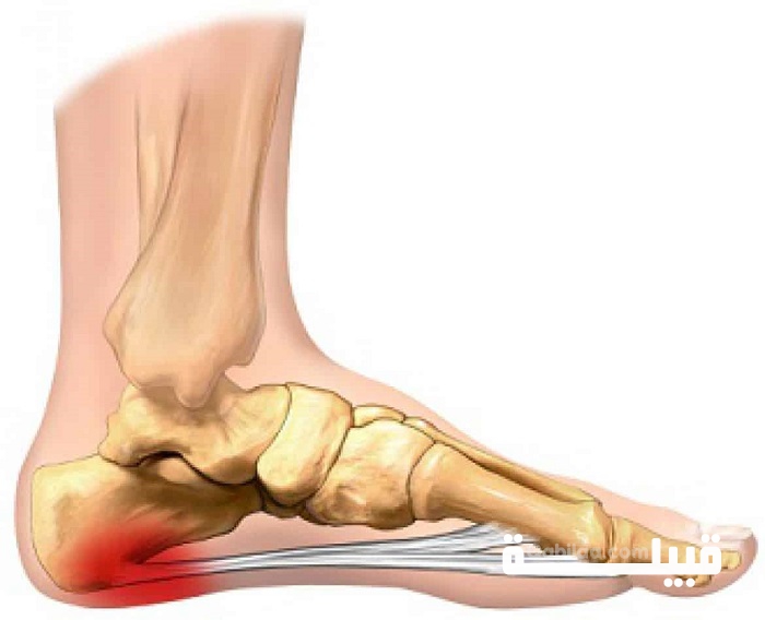 علاج وجع كعب الرجل