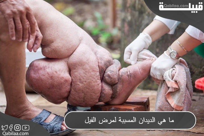 ما هي الديدان المسببة لمرض الفيل