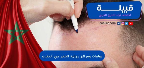 عيادات ومراكز زراعة الشعر في المغرب