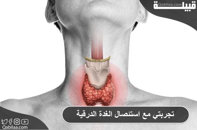 تجربتي مع استئصال الغدة الدرقية