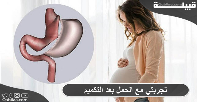 تجربتي مع الحمل بعد التكميم