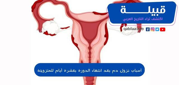 أسباب نزول دم بعد انتهاء الدورة بعشرة أيام للمتزوجة