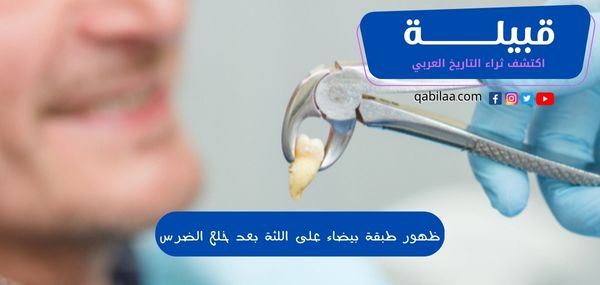 ظهور طبقة بيضاء على اللثة بعد خلع الضرس