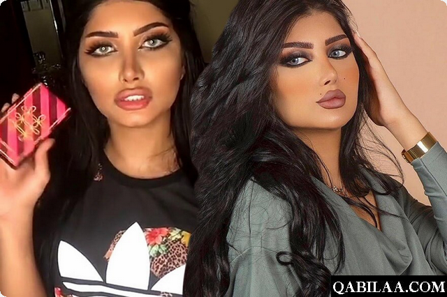 صور ملكة كابلي قبل التجميل وبعده