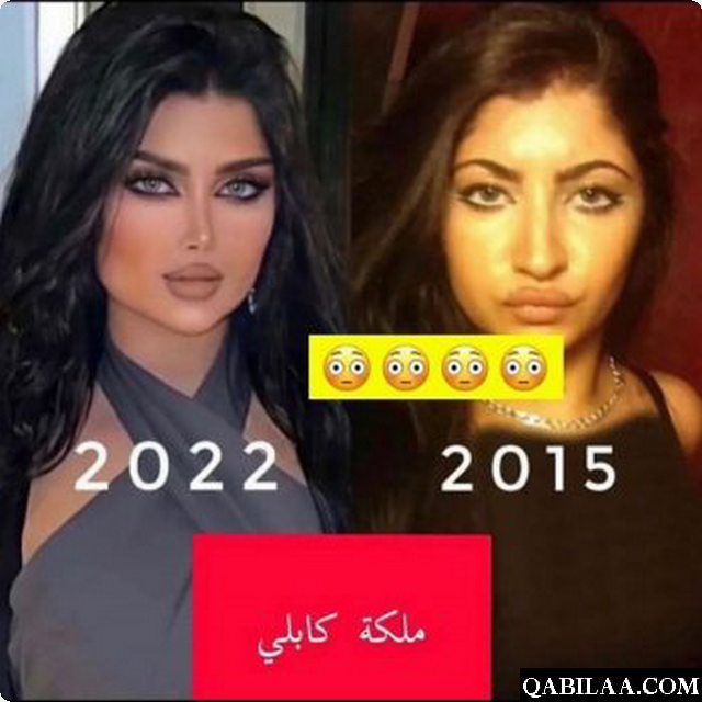 صور ملكة كابلي قبل التجميل وبعده