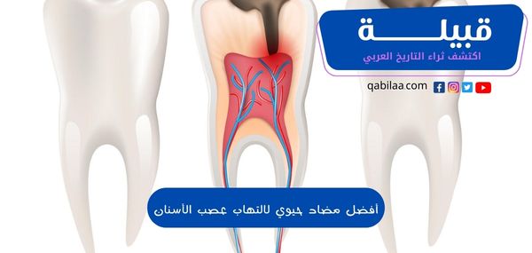 أفضل مضاد حيوي لالتهاب عصب الأسنان