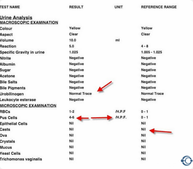 شرح نتائج تحليل البول الكامل